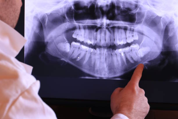 Best Same-Day Emergency Dental Services in Granite, OK